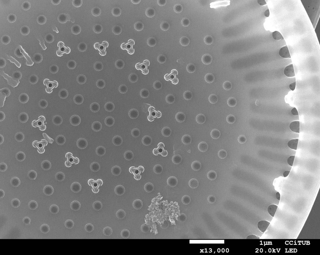 Zdjęcie spod mikroskopu elektronowego - okrzemka centryczna