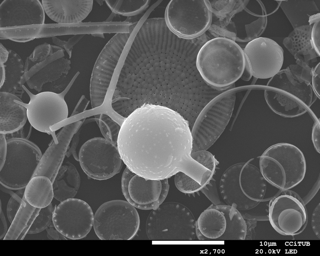 Zdjęcie spod mikroskopu elektronowego - cysty złotowiciowców